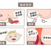 痔疮对胎儿有影响吗（孕妇有痔疮对胎儿有影响吗）