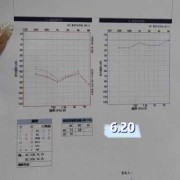 胎儿耳聋（胎儿耳朵聋能不能检查出来）