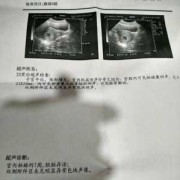 医生说胎儿偏小怎么办（检查医生说胎儿偏小怎么办）