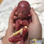 19周孩子可不可以打掉,孕19周胎儿图片欣赏