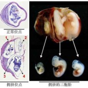 胎儿生化是什么意思（孕妇胎儿生化是什么意思）