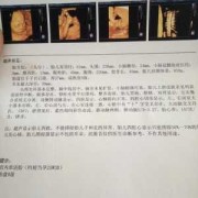 孕期四维查什么（孕期检查四维是查什么）