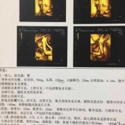 系统胎儿超声检查（系统彩超和四维彩超的区别）