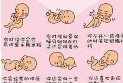 胎儿鼓包算一次胎动吗（孕25周，胎动频繁，肚子有时候还会鼓包怎么回事）