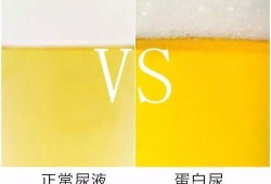 孕妇尿有泡沫是怎么回事,孕期小便有泡沫正常吗