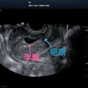 b超胎儿脸（小孩脸部划伤怎么办？什么方法可以去除疤痕）