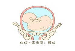 胎儿横径（胎儿横径是什么意思）