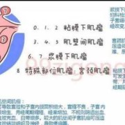 孕期肌瘤疼（孕期肌瘤疼痛多久会缓解）