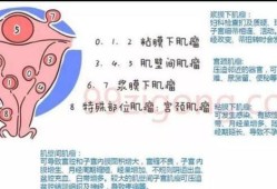 孕期肌瘤疼（孕期肌瘤疼痛多久会缓解）