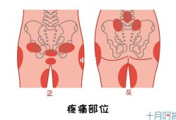 孕妇臀部酸痛,孕期臀部疼是什么原因
