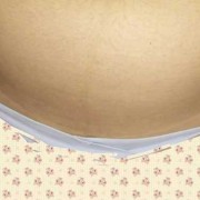 孕期妊娠线（为什么怀孕没有妊娠线啊）