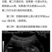 刚出生的婴儿怎么辨别男孩女孩,胎儿男女怎么看b超单