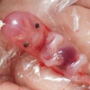 晚孕期出血（孕30周出血去医院保胎半个月出院，回来后还有少量褐色分泌物是怎么回事）