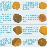 孕期屎很多（孕期屎很多怎么回事）