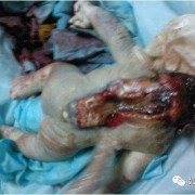 胎儿致死性畸形（胎儿致死性畸形）
