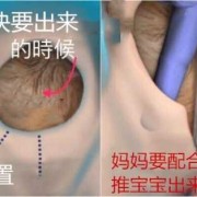 孕40周胎儿孕检估计8斤能顺产吗,胎儿多大可以顺产不侧切