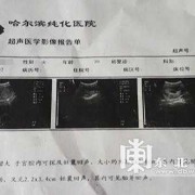 孕期b超检查结果（孕早期b超ut是什么？能看出什么呢）