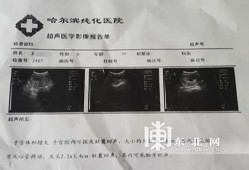 孕期b超检查结果（孕早期b超ut是什么？能看出什么呢）