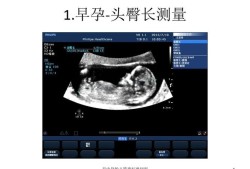 胎儿超声切面（NT超声孕龄13W＋1d是什么意思）