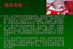 胎儿缺氧早期表现为（刚出生的新生儿脑缺氧会有什么症状）