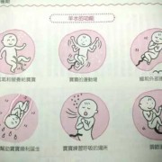 胎儿的活动（羊水的功能是限制胎儿的活动）