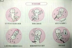 胎儿的活动（羊水的功能是限制胎儿的活动）