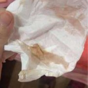 孕期出血正常吗（在易孕期出血正常吗）