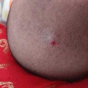 婴儿前囟门凸起怎么回事,胎儿前囟门和后囟门的区别