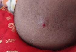 婴儿前囟门凸起怎么回事,胎儿前囟门和后囟门的区别