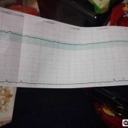 胎心低是什么原因,胎儿胎心低是什么原因造成的