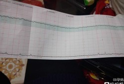 胎心低是什么原因,胎儿胎心低是什么原因造成的