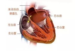 卵孔是什么,胎儿心脏有孔是什么导致