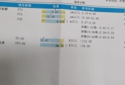 孕期tsh正常值是多少,孕期甲状腺素偏高对胎儿有影响吗