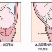 孕期宫颈长度（怀孕24周宫颈管多长是正常）