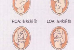 左枕前位真人胎儿图（胎儿呈枕左前位是什么意）