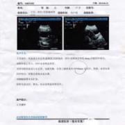 胎儿右肾有囊肿怎么办（右肾囊肿是怎么一回事呢）