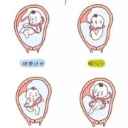 孕28周Ｂ超时检查说宝宝脐带绕颈一周对胎儿有影响吗,脐带打结对胎儿的影响大吗