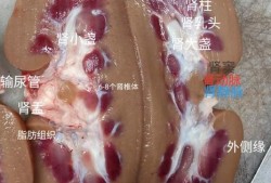 猪肾的结构名称,胎儿肾椎体肿胀怎么办