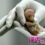 三个半月胎儿高清图片（三个半月胎儿高清图片 男孩）
