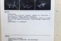 孕期彩超图片（孕期彩超图片怎么看）