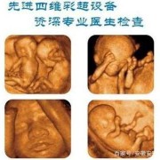 侏儒兔花生胎是什么意思,侏儒症胎儿在肚子里能检查出来吗