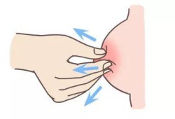 顺产后乳腺不通怎么办？有什么办法能通乳腺的吗,孕期疏通乳腺的方法