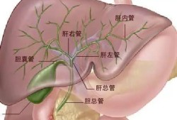 双胆囊是病吗,胎儿胆囊偏小是畸形吗严重吗
