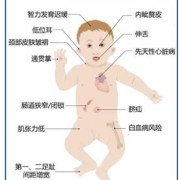 怀唐氏儿的孕妈妈有什么症状呀,唐氏儿孕妇孕期症状