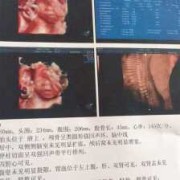 胎儿六个月四维彩超（胎儿六个月四维彩超图片）