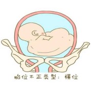 30周胎儿在母体的姿势（30周胎儿在母体的姿势是横位）