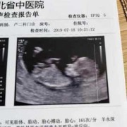 鼻梁骨的正常宽度,胎儿鼻骨各孕期参照