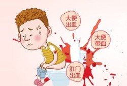 孕期便秘痔疮大便出血对宝宝有影响吗,孕期大出血对孩子影响大吗