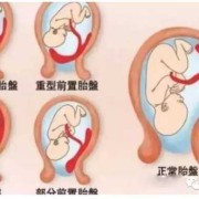 胎儿胎盘（胎儿胎盘什么时候长出来）
