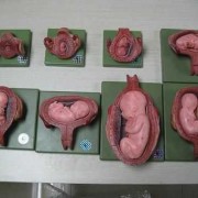 7个月胎儿多重（7个月胎儿多重属于正常）